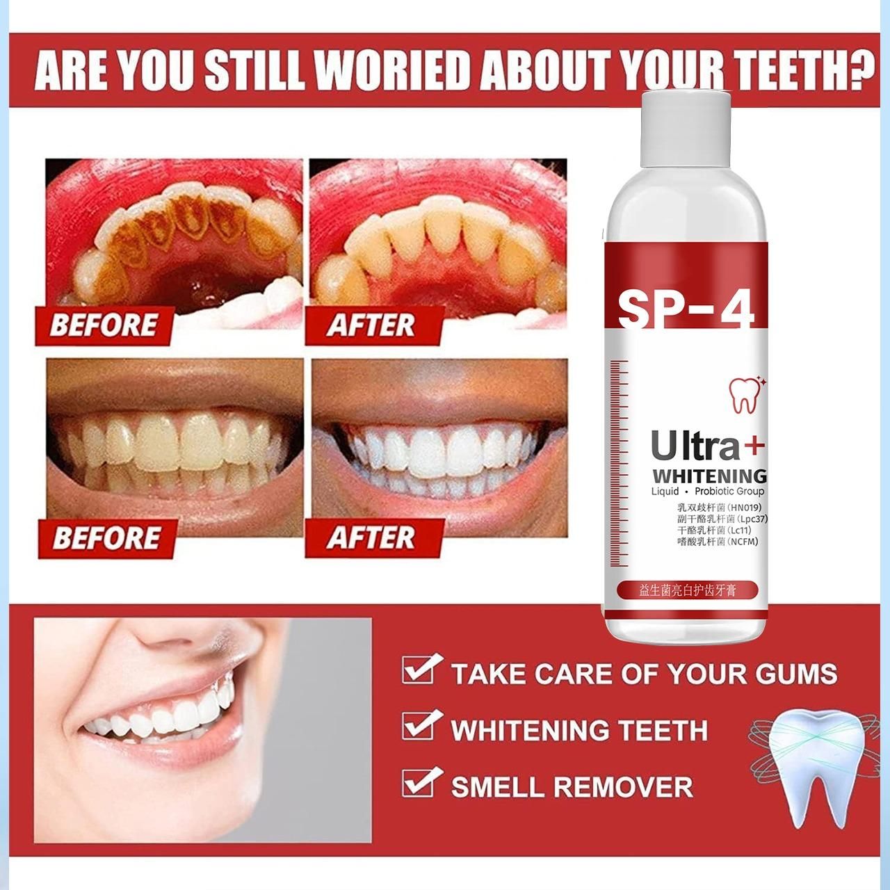 SP-4 Ultra+ Whitening Teeth (Pack of 1)